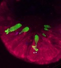 Mucus is Retained in Cystic Fibrosis Patients’ Cells, Leads to Potentially Deadly Infections