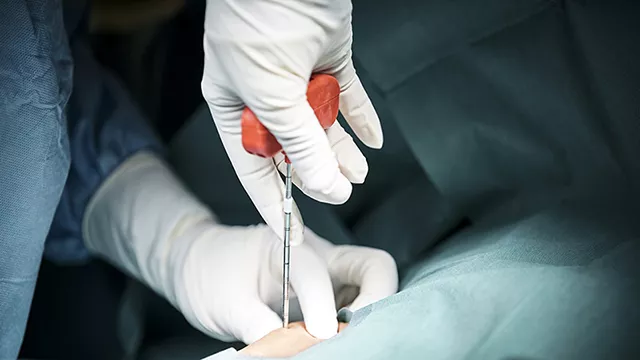 bone-marrow-harvesting-GettyImages-1010678586%20640x360.jpg